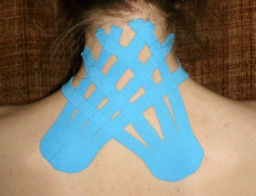 Do You Make These Common Kinesio Taping Mistakes?